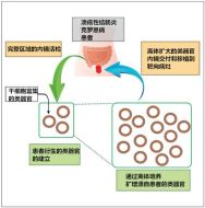 研究揭示炎症性肠病的核心成因